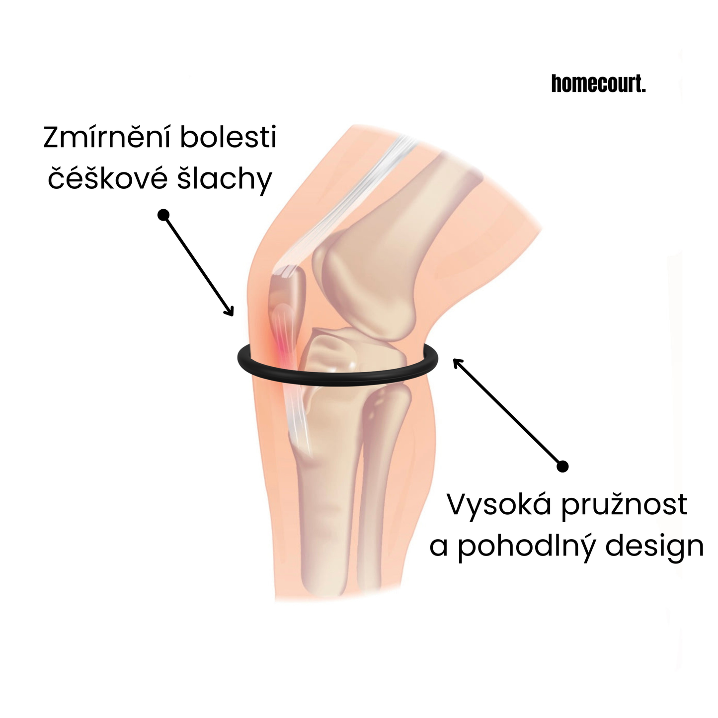 Patella band