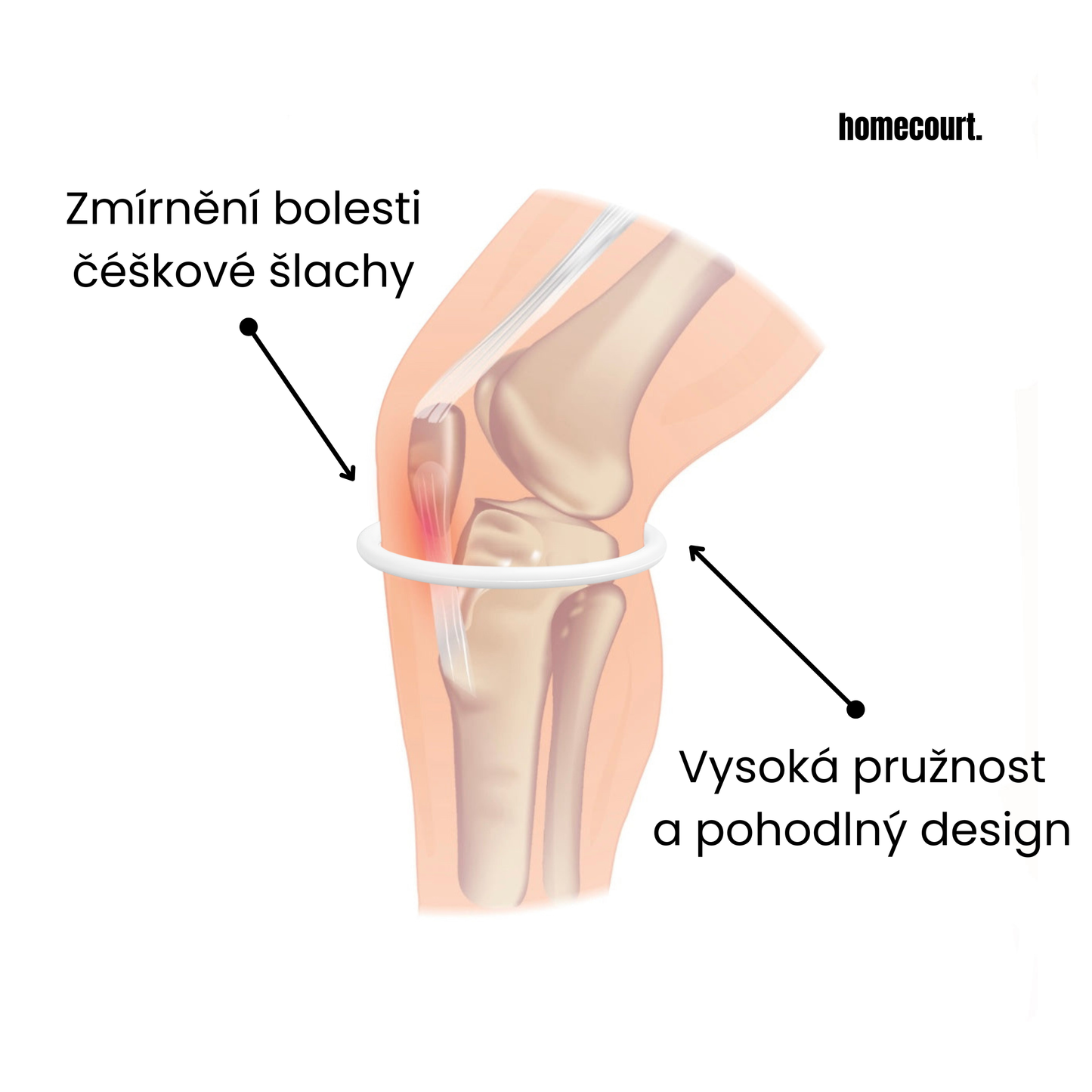 Patella band